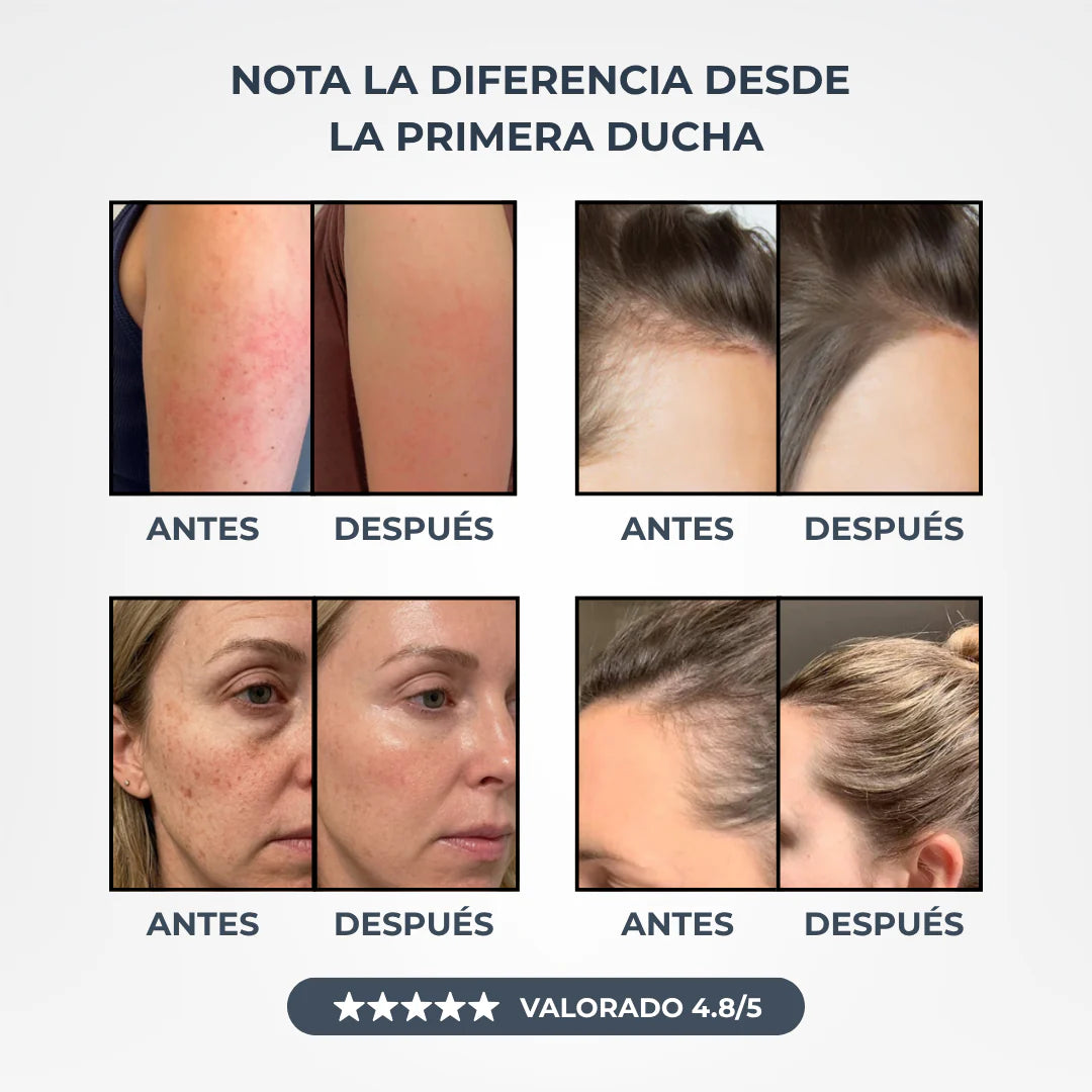 Transforma tu Pelo, tu Piel y tu Ducha con Soralya