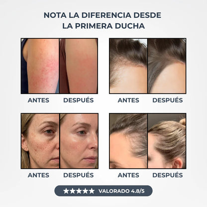 Transforma tu Pelo, tu Piel y tu Ducha con Soralya