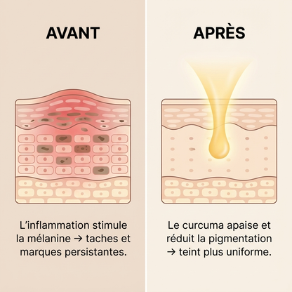 SAVON AU CURCUMA ANTI-HYPERPIGMENTATION