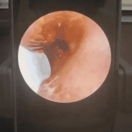 Otovision™ – Smart Ear Cleaning Camera (Copy)