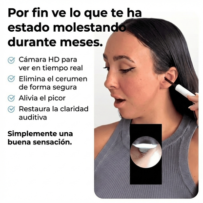 Otovision™ – Cámara inteligente para la limpieza de oídos