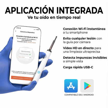 Otovision™ – Cámara inteligente para la limpieza de oídos