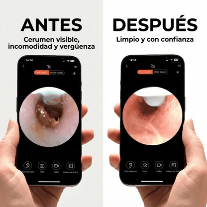 Otovision™ – Cámara inteligente para la limpieza de oídos