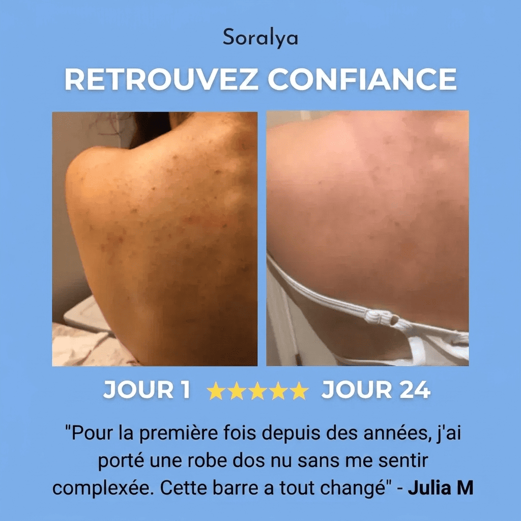 SAVON ANTI ACNÉ DU DOS