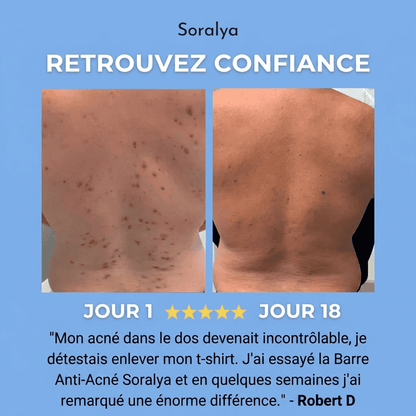 SAVON ANTI ACNÉ DU DOS