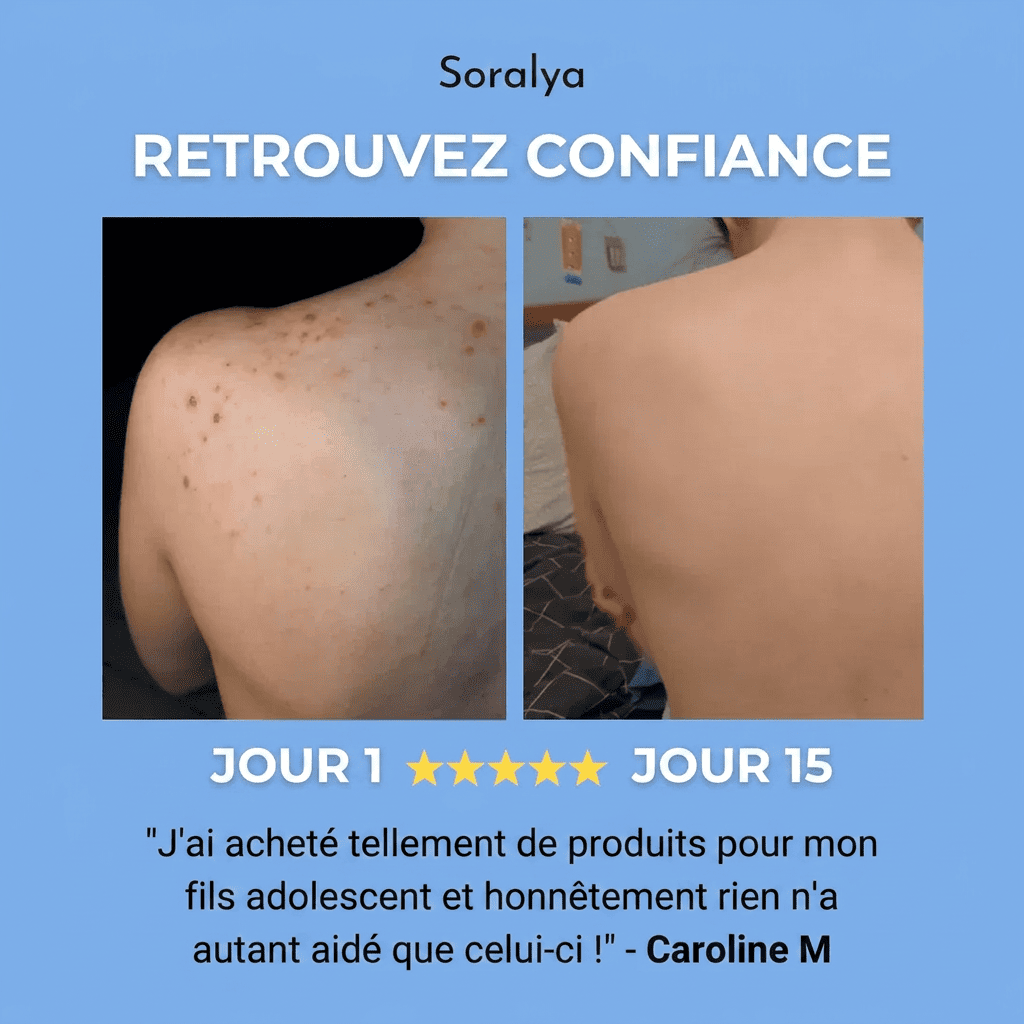 SAVON ANTI ACNÉ DU DOS