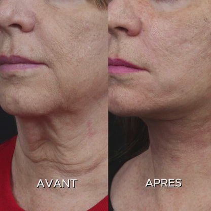 Hydralya - Roll-on Aux Peptides