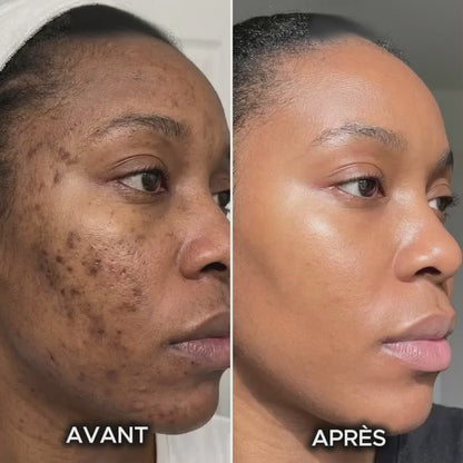 SAVON AU CURCUMA ANTI-HYPERPIGMENTATION