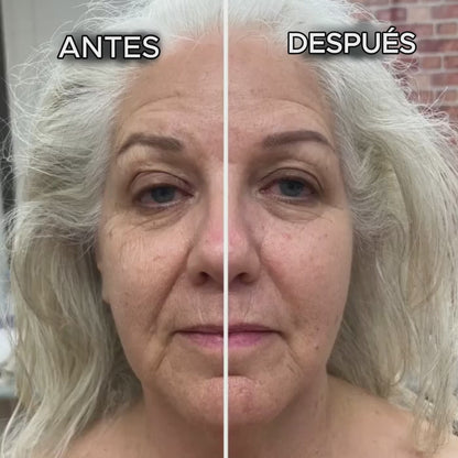 Cepillo linfático Soralya